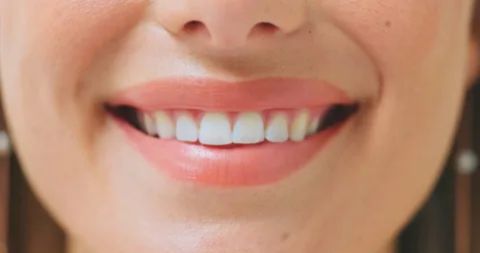 Close-up of a smiling mouth and healthy pink lips, highlighting straight and perfectly white teeth to illustrate the direct impact of oral health on appearance.